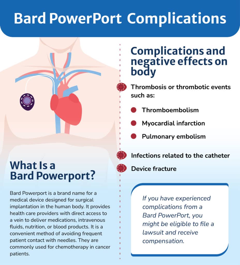 Bard Poer Port Complications Bard Poer Port Complications